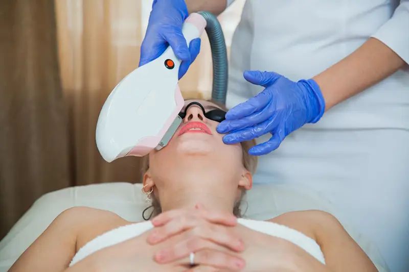 Pacientă tratată cu Contour Laser Skin Peel