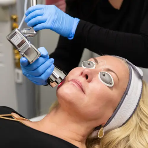 Pacientă în timpul operației cu laser ProFractional