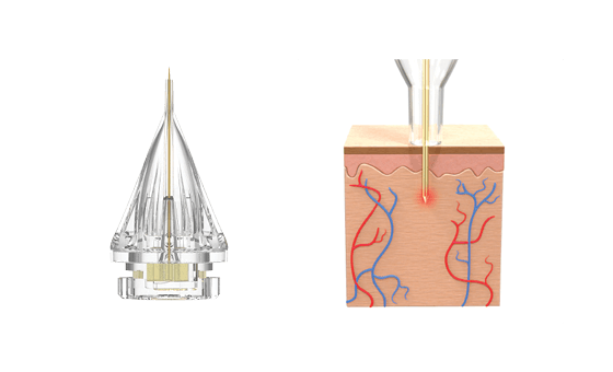 O femeie privește spre aparat